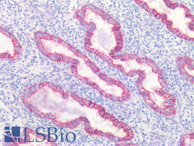 CLDN3 / Claudin 3 Antibody - Human Uterus: Formalin-Fixed, Paraffin-Embedded (FFPE)
