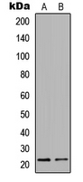CLDN3 / Claudin 3 Antibody - Western blot analysis of Claudin 3 expression in SW480 (A); LOVO (B) whole cell lysates.