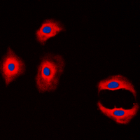 CLDN3 / Claudin 3 Antibody - Immunofluorescent analysis of Claudin 3 staining in MCF7 cells. Formalin-fixed cells were permeabilized with 0.1% Triton X-100 in TBS for 5-10 minutes and blocked with 3% BSA-PBS for 30 minutes at room temperature. Cells were probed with the primary antibody in 3% BSA-PBS and incubated overnight at 4 C in a humidified chamber. Cells were washed with PBST and incubated with a DyLight 594-conjugated secondary antibody (red) in PBS at room temperature in the dark. DAPI was used to stain the cell nuclei (blue).