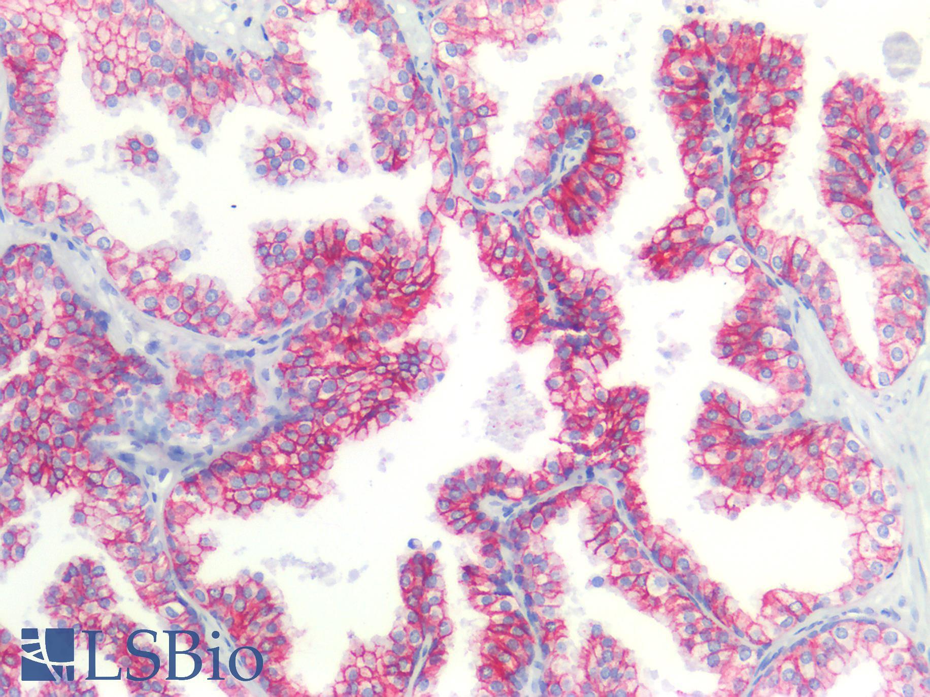 CLDN3 / Claudin 3 Antibody - Human Prostate: Formalin-Fixed, Paraffin-Embedded (FFPE)