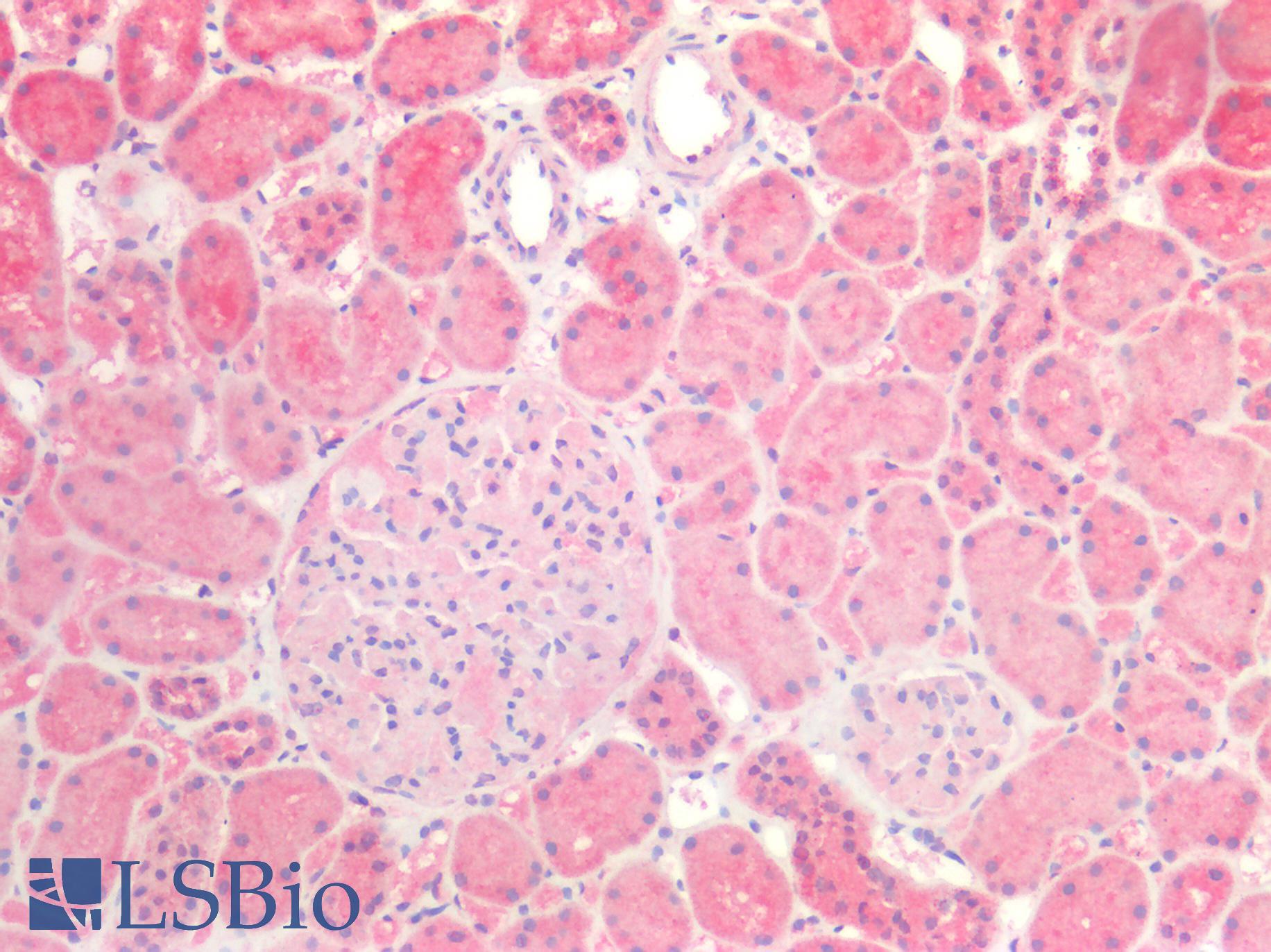 CLDN3 / Claudin 3 Antibody - Human Kidney: Formalin-Fixed, Paraffin-Embedded (FFPE)