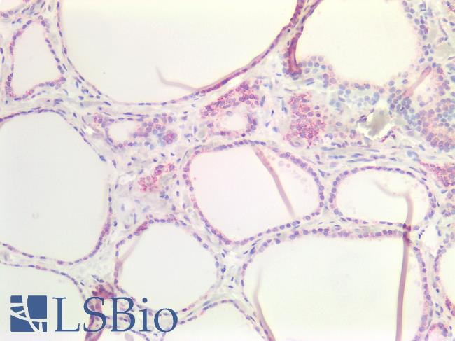 CLDN3 / Claudin 3 Antibody - Human Thyroid: Formalin-Fixed, Paraffin-Embedded (FFPE)