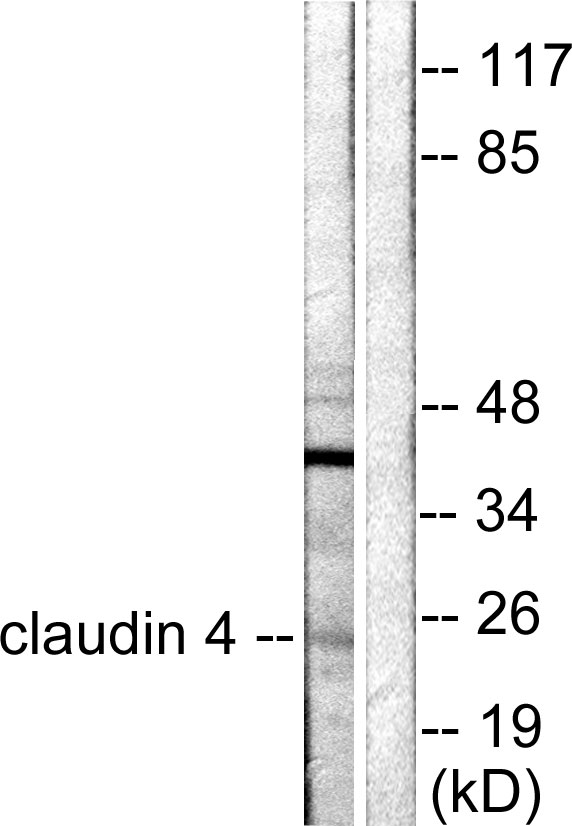 CLDN4 / Claudin 4 Antibody - Western blot analysis of lysates from HeLa cells, using Claudin 4 Antibody. The lane on the right is blocked with the synthesized peptide.