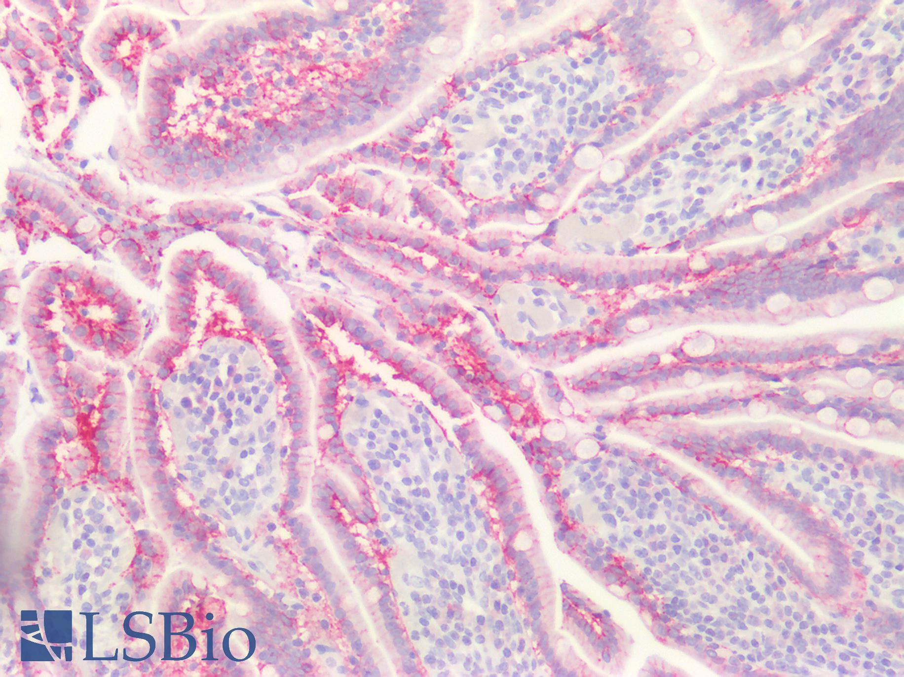 CLDN4 / Claudin 4 Antibody - Human Small Intestine: Formalin-Fixed, Paraffin-Embedded (FFPE)