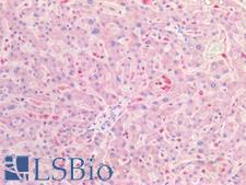 CLDN5 / Claudin 5 Antibody - Human Liver: Formalin-Fixed, Paraffin-Embedded (FFPE)