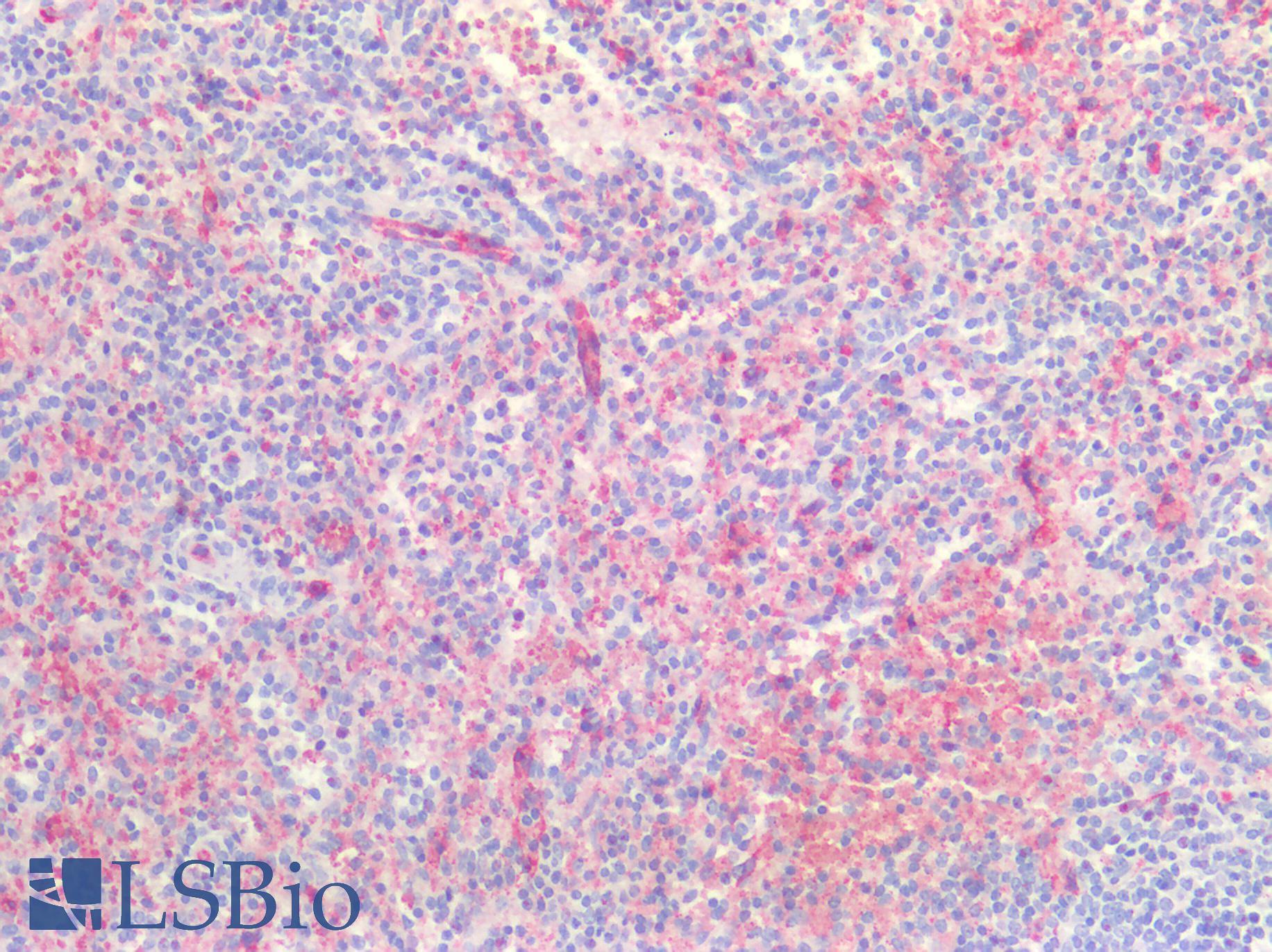 CLDN5 / Claudin 5 Antibody - Human Spleen: Formalin-Fixed, Paraffin-Embedded (FFPE)