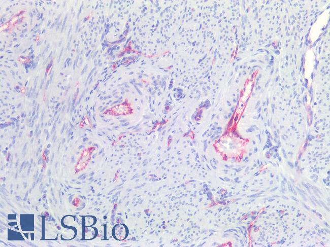 CLDN5 / Claudin 5 Antibody - Human Uterus: Formalin-Fixed, Paraffin-Embedded (FFPE)