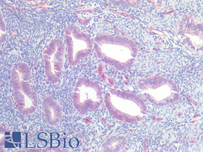 CLDN5 / Claudin 5 Antibody - Human Uterus: Formalin-Fixed, Paraffin-Embedded (FFPE)