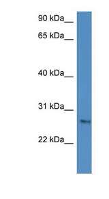 CMA1 / Mast Cell Chymase Antibody - CMA1 / Mast Cell Chymase antibody western blot of COLO205 cell lysate.  This image was taken for the unconjugated form of this product. Other forms have not been tested.