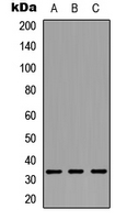 CNN1 / Calponin Antibody - Western blot analysis of Calponin 1 expression in HEK293T (A); Raw264.7 (B); H9C2 (C) whole cell lysates.