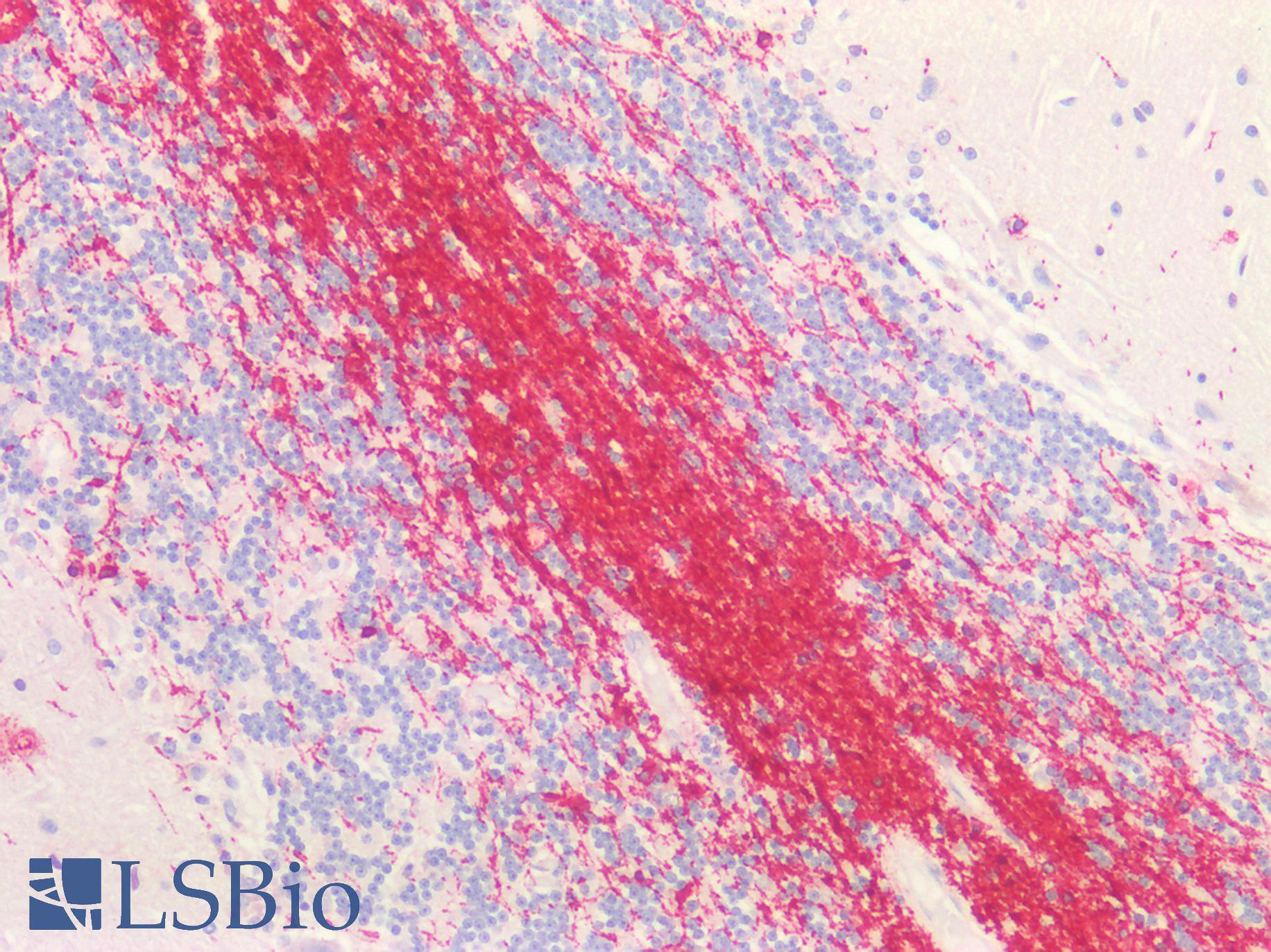 CNPase Antibody - Human Brain, Cerebellum: Formalin-Fixed, Paraffin-Embedded (FFPE)