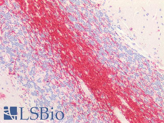 CNPase Antibody - Human Brain, Cerebellum: Formalin-Fixed, Paraffin-Embedded (FFPE)