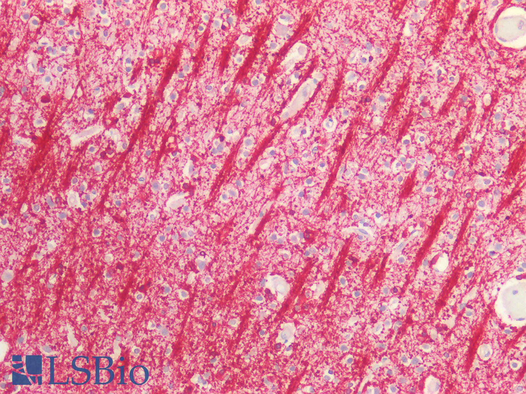 CNPase Antibody - Human Brain, Cortex: Formalin-Fixed, Paraffin-Embedded (FFPE)