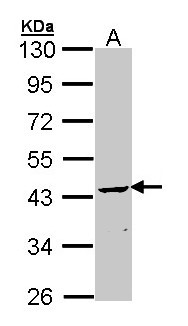 CNPase Antibody - Sample (30 ug of whole cell lysate). A: Molt-4. 10% SDS PAGE. CNP antibody diluted at 1:1000. 