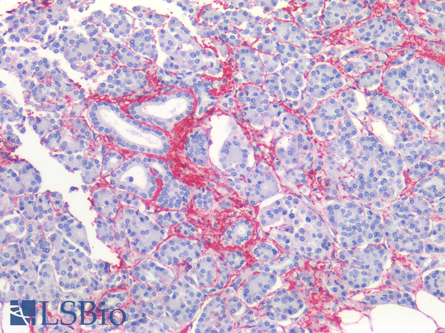 COL1A1 / Collagen I Alpha 1 Antibody - Human Pancreas: Formalin-Fixed, Paraffin-Embedded (FFPE)
