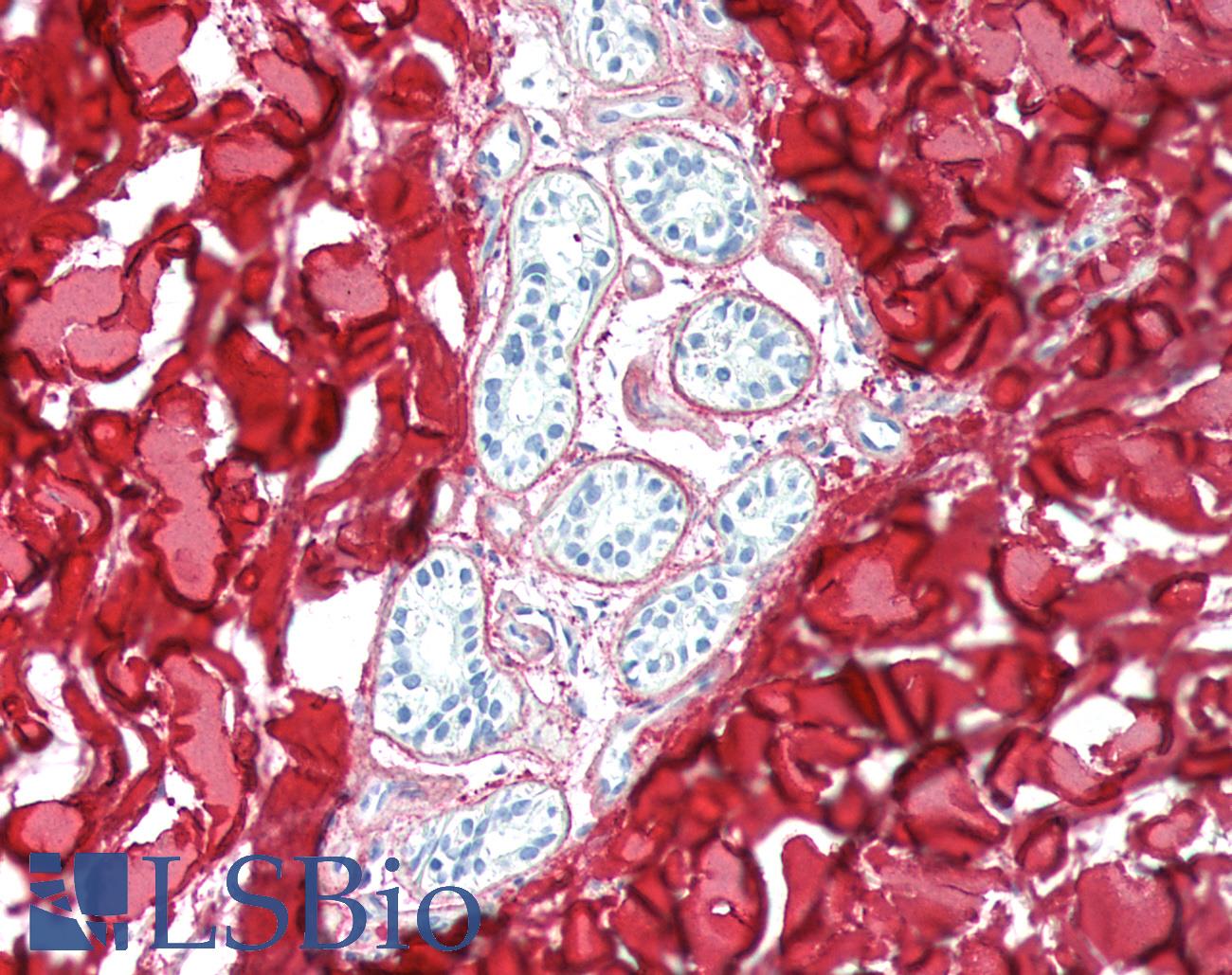 COL3A1 / Collagen III Antibody - Human Skin, Dermis: Formalin-Fixed, Paraffin-Embedded (FFPE)