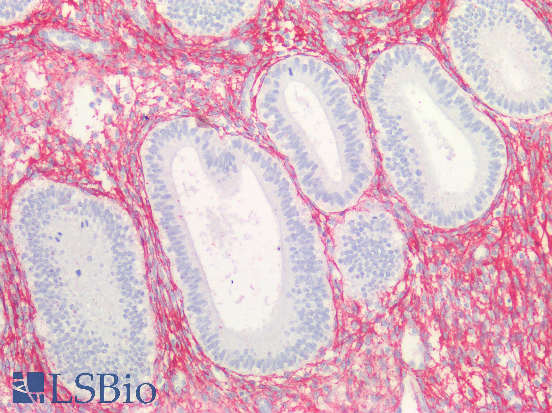COL3A1 / Collagen III Antibody - Human Uterus: Formalin-Fixed, Paraffin-Embedded (FFPE)