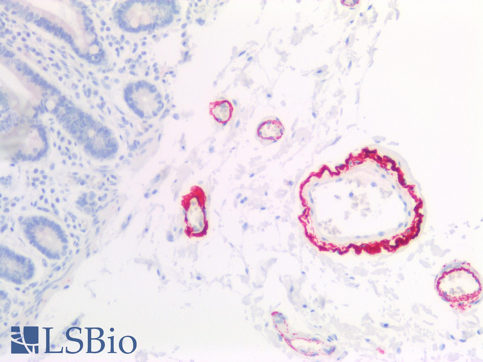 COL8A1 / Collagen VIII Alpha 1 Antibody - Human Small Intestine: Formalin-Fixed, Paraffin-Embedded (FFPE)