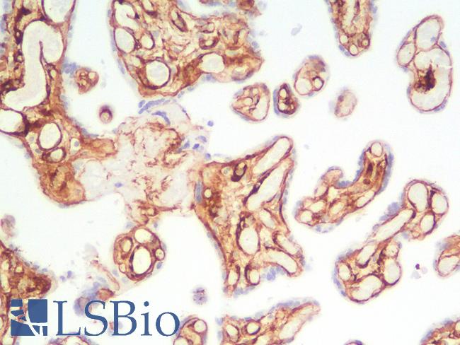 Collagen IV Antibody - Human Placenta: Formalin-Fixed, Paraffin-Embedded (FFPE)