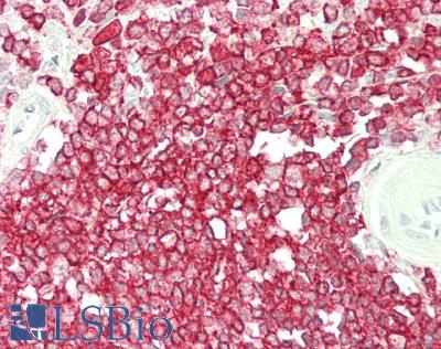 CORO1A / Coronin 1a Antibody - Human Spleen: Formalin-Fixed, Paraffin-Embedded (FFPE)