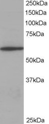 CORO1A / Coronin 1a Antibody - Antibody staining (0.3 ug/ml) of Jurkat lysate (RIPA buffer, 35 ug total protein per lane). Primary incubated for 1 hour. Detected by Western blot of chemiluminescence.