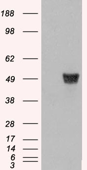 CORO1A / Coronin 1a Antibody - HEK293 overexpressing CORO1A (RC210753) and probed with (mock transfection in first lane).