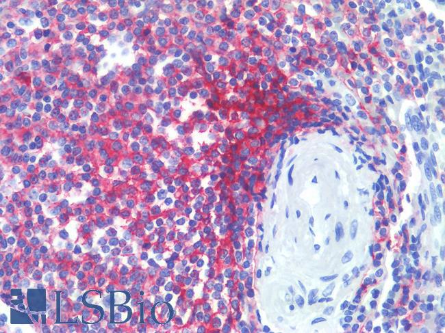 CR1 / CD35 Antibody - Human Spleen: Formalin-Fixed, Paraffin-Embedded (FFPE)