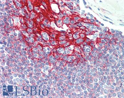 CR2 / CD21 Antibody - Human Spleen: Formalin-Fixed, Paraffin-Embedded (FFPE)