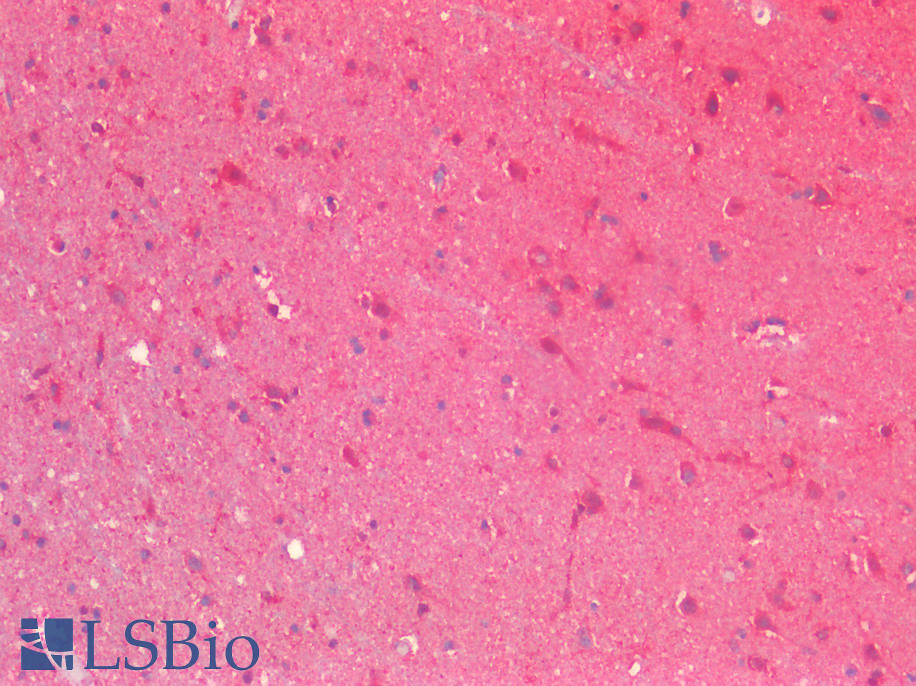 CRBN / Cereblon Antibody - Human Brain, Cortex: Formalin-Fixed, Paraffin-Embedded (FFPE)