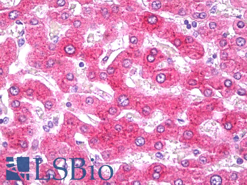 CRP / C-Reactive Protein Antibody - Anti-CRP antibody IHC of human liver. Immunohistochemistry of formalin-fixed, paraffin-embedded tissue after heat-induced antigen retrieval. Antibody dilution 10 ug/ml.