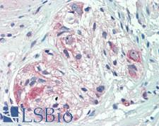 CSPG4 / NG2 Antibody - Human Small Intestine, Myenteric Plexus: Formalin-Fixed, Paraffin-Embedded (FFPE)