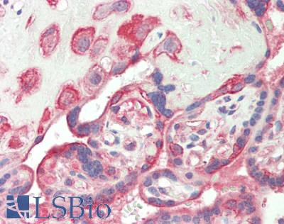 CSPG4 / NG2 Antibody - Human Placenta: Formalin-Fixed, Paraffin-Embedded (FFPE)