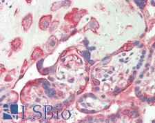 CSPG4 / NG2 Antibody - Human Placenta: Formalin-Fixed, Paraffin-Embedded (FFPE)