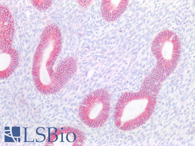CTNNB1 / Beta Catenin Antibody - Human Uterus: Formalin-Fixed, Paraffin-Embedded (FFPE)