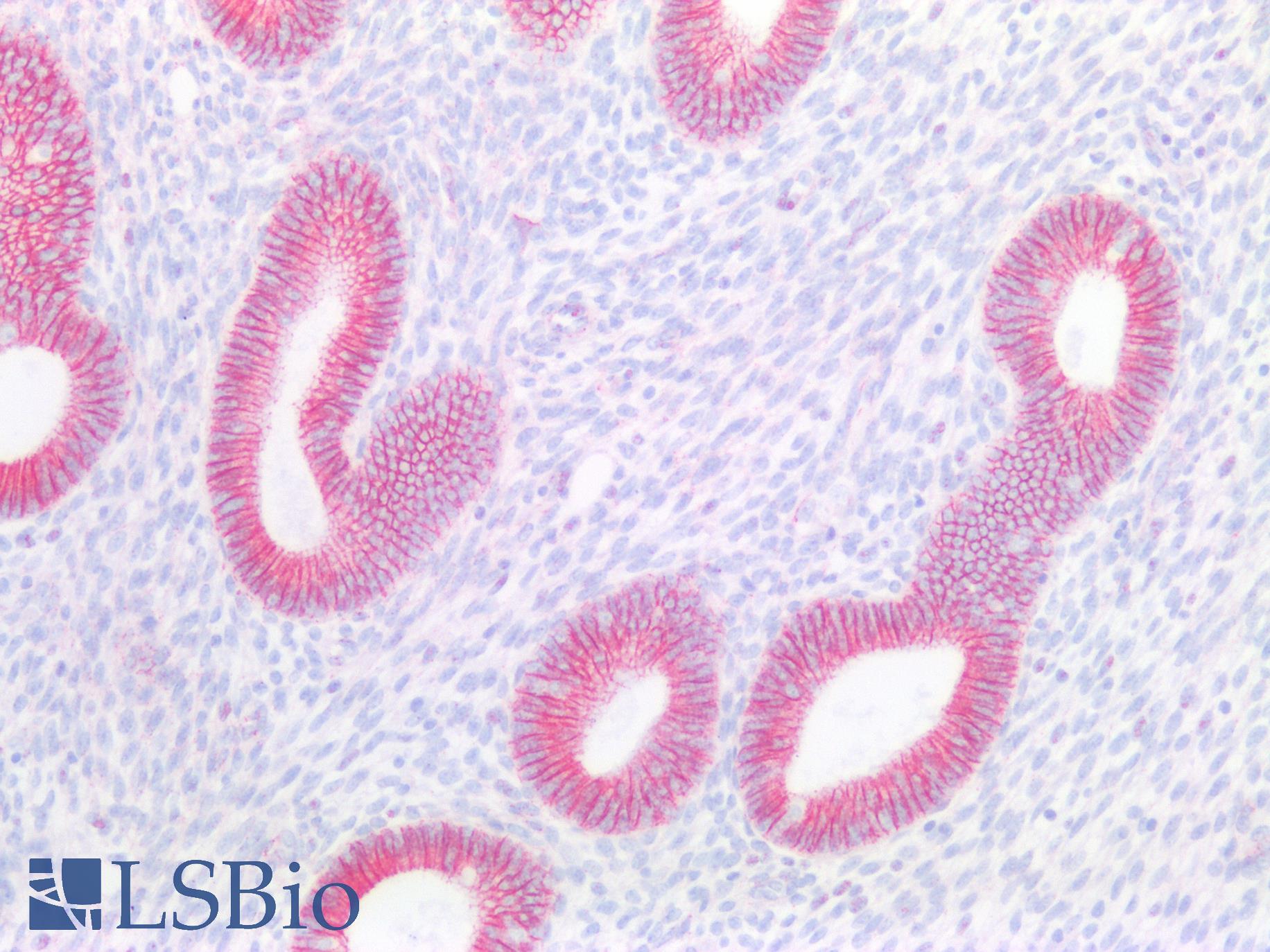 CTNNB1 / Beta Catenin Antibody - Human Uterus: Formalin-Fixed, Paraffin-Embedded (FFPE)
