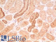 CTNNB1 / Beta Catenin Antibody - Human Kidney: Formalin-Fixed, Paraffin-Embedded (FFPE)