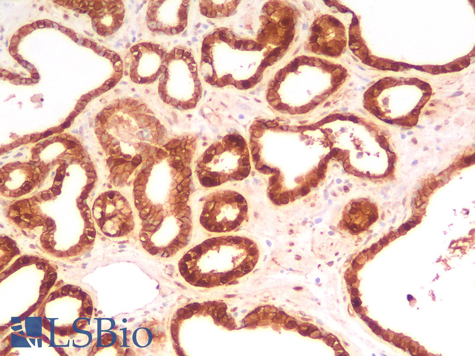 CTNNB1 / Beta Catenin Antibody - Human Prostate: Formalin-Fixed, Paraffin-Embedded (FFPE)