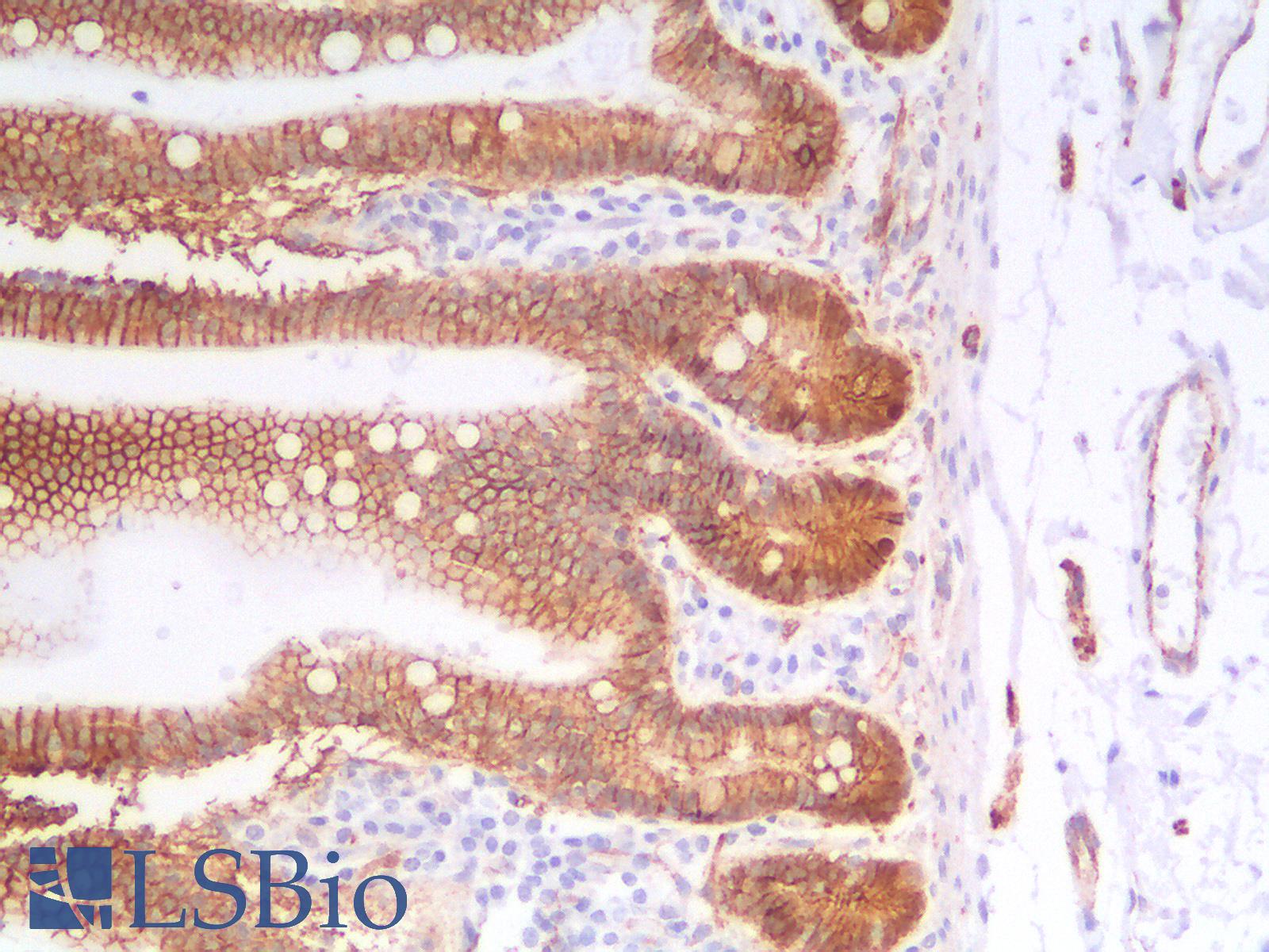 CTNNB1 / Beta Catenin Antibody - Human Small Intestine: Formalin-Fixed, Paraffin-Embedded (FFPE)