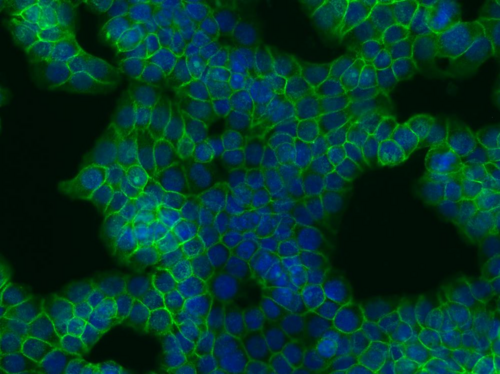 CTNNB1 / Beta Catenin Antibody - Immunocytochemistry staining of beta-catenin in human colon adenocarcinoma cell line HT29 using EM-22 antibody (green). Cell nuclei visualized by DAPI (blue).