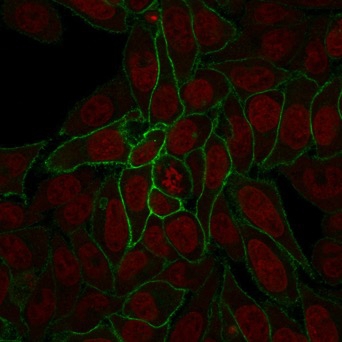 CTNNB1 / Beta Catenin Antibody - Confocal Immunofluorescence image of HeLa cells using Beta-Catenin Mouse Recombinant Monoclonal Ab (rCTNNB1/2173).Green (CF488) and Reddot is used to label the nuclei.