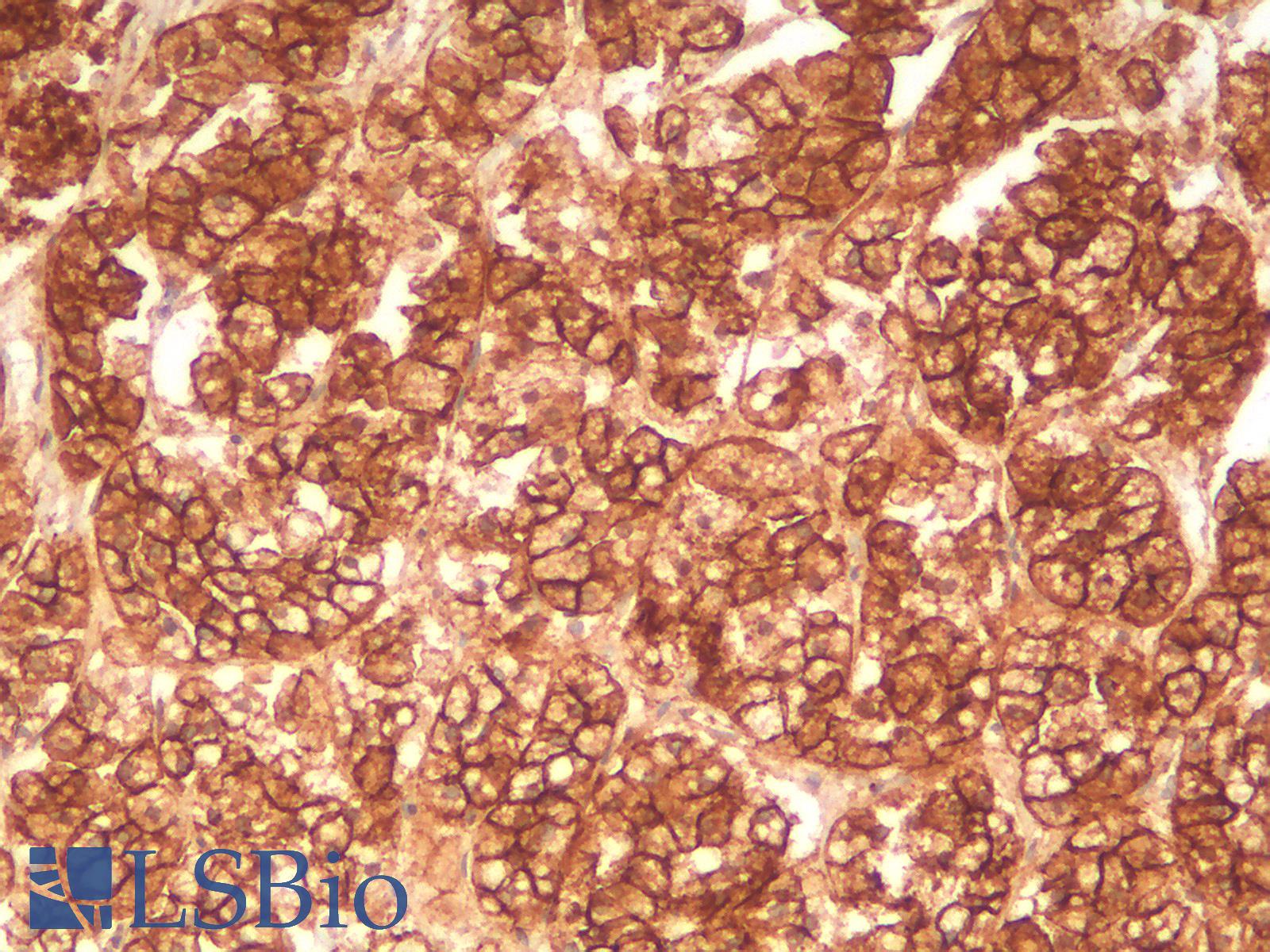 CTNNB1 / Beta Catenin Antibody - Human Adrenal: Formalin-Fixed, Paraffin-Embedded (FFPE)