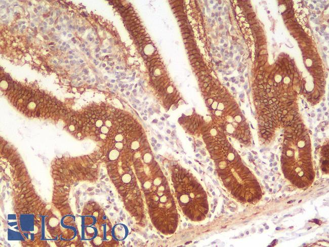 CTNNB1 / Beta Catenin Antibody - Human Small Intestine: Formalin-Fixed, Paraffin-Embedded (FFPE)