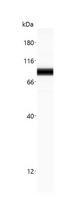 CTNNB1 / Beta Catenin Antibody - Anti-CTNNB1 antibody (LS-A10841, 20 µg/mL) yields a specific band on capillary Western analysis (Protein Simple, WES, 12-230 kDa separation module) in 0.25 mg/mL human beta-catenin overexpression lysate.