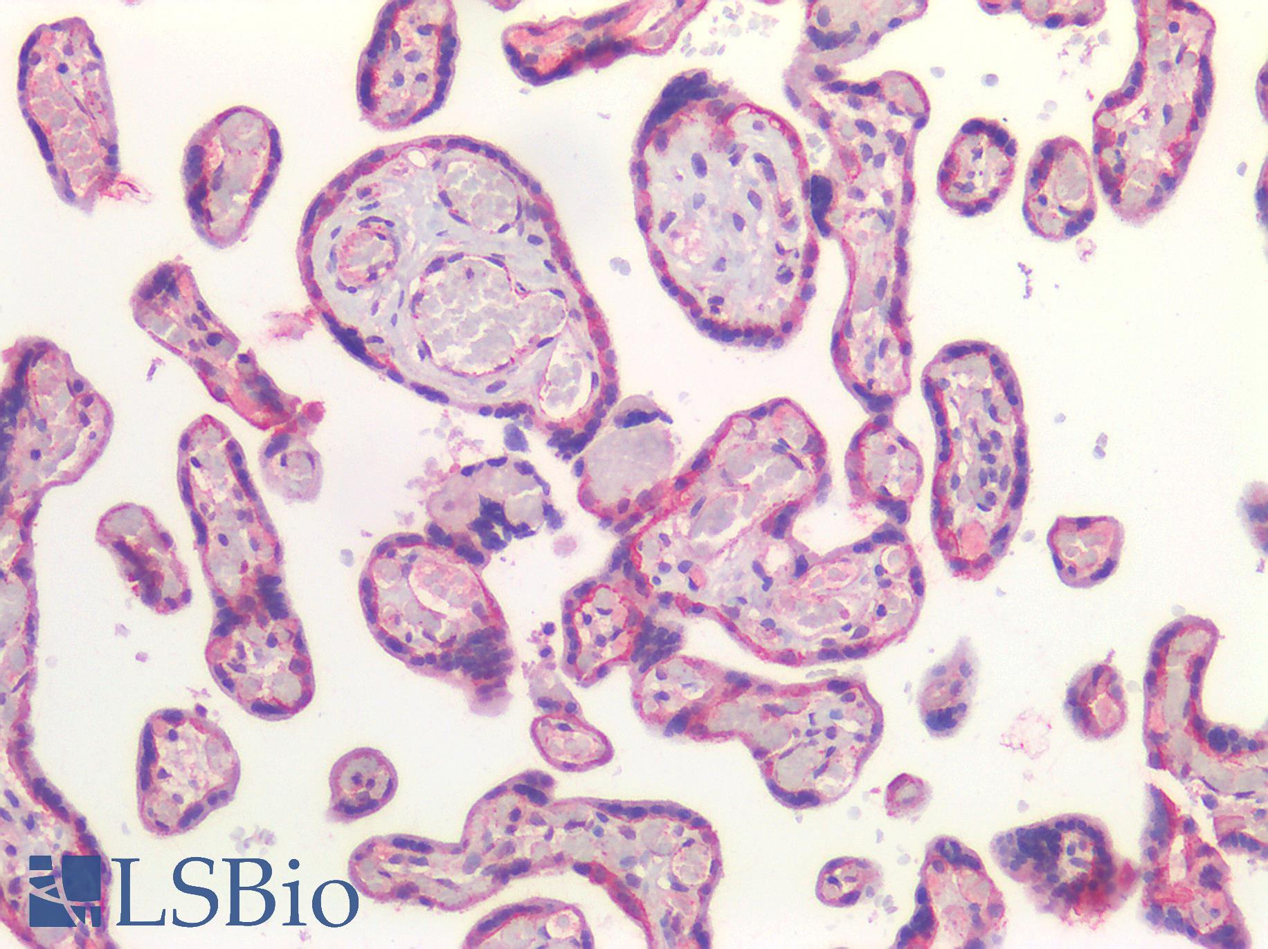 CTNNB1 / Beta Catenin Antibody - Human Placenta: Formalin-Fixed, Paraffin-Embedded (FFPE)