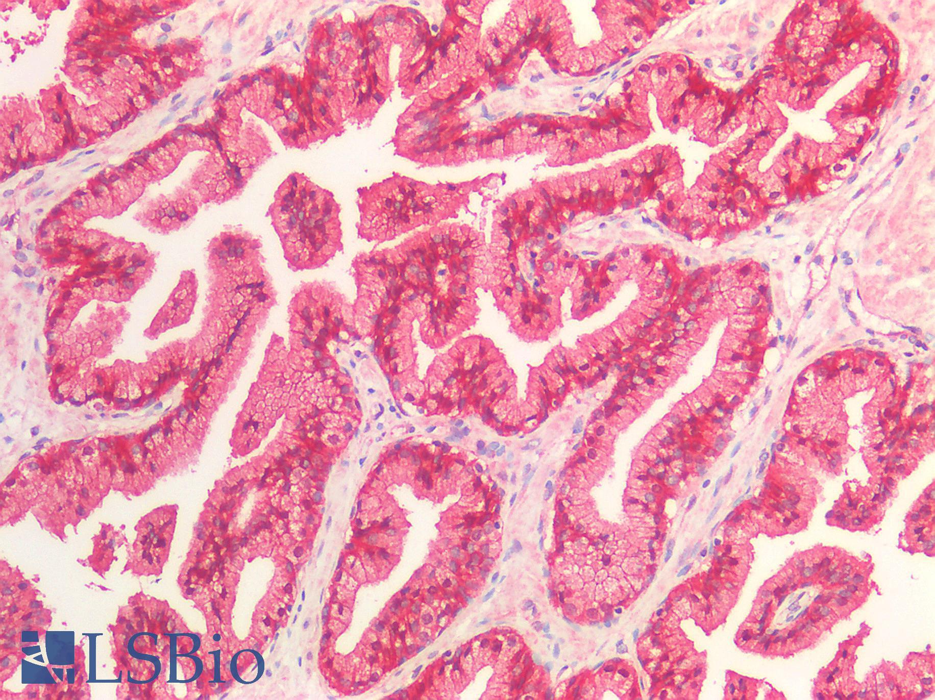 CTNNB1 / Beta Catenin Antibody - Human Placenta: Formalin-Fixed, Paraffin-Embedded (FFPE)