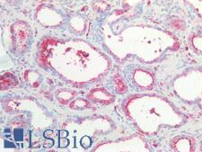 CTNNBIP1 / ICAT Antibody - Human Prostate: Formalin-Fixed, Paraffin-Embedded (FFPE)