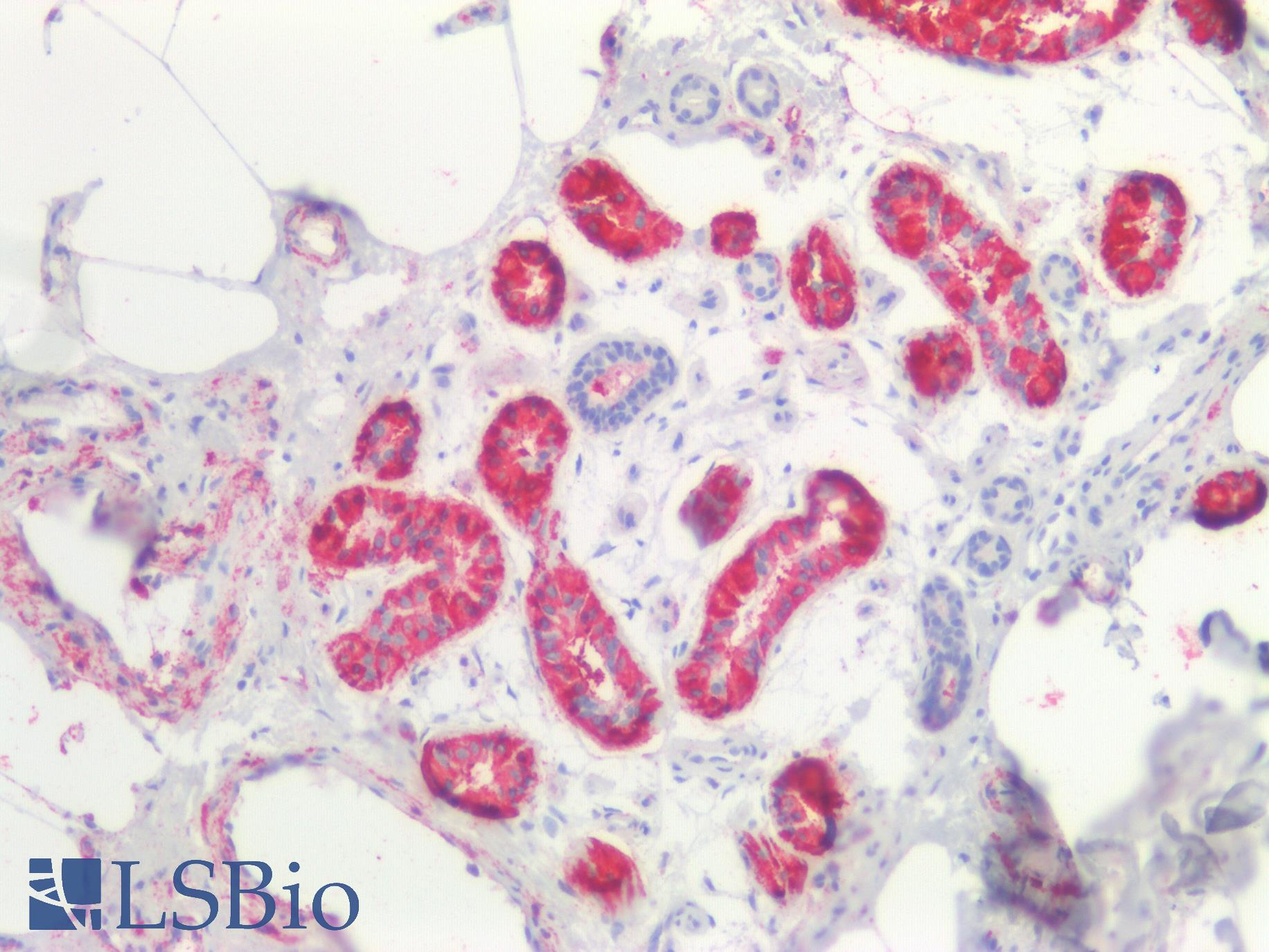 CTNNBIP1 / ICAT Antibody - Human Skin: Formalin-Fixed, Paraffin-Embedded (FFPE)