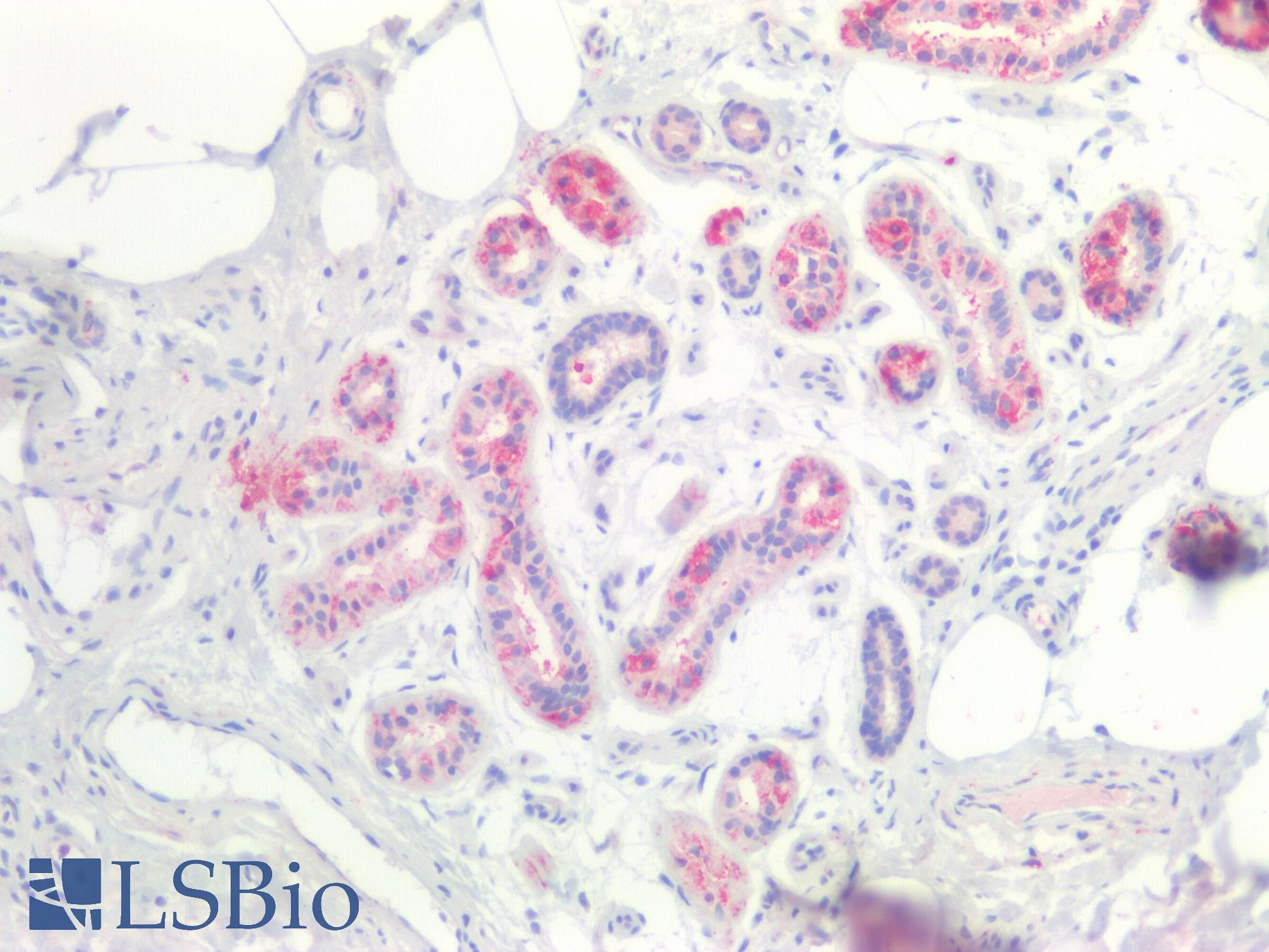 CTNNBIP1 / ICAT Antibody - Human Skin: Formalin-Fixed, Paraffin-Embedded (FFPE)