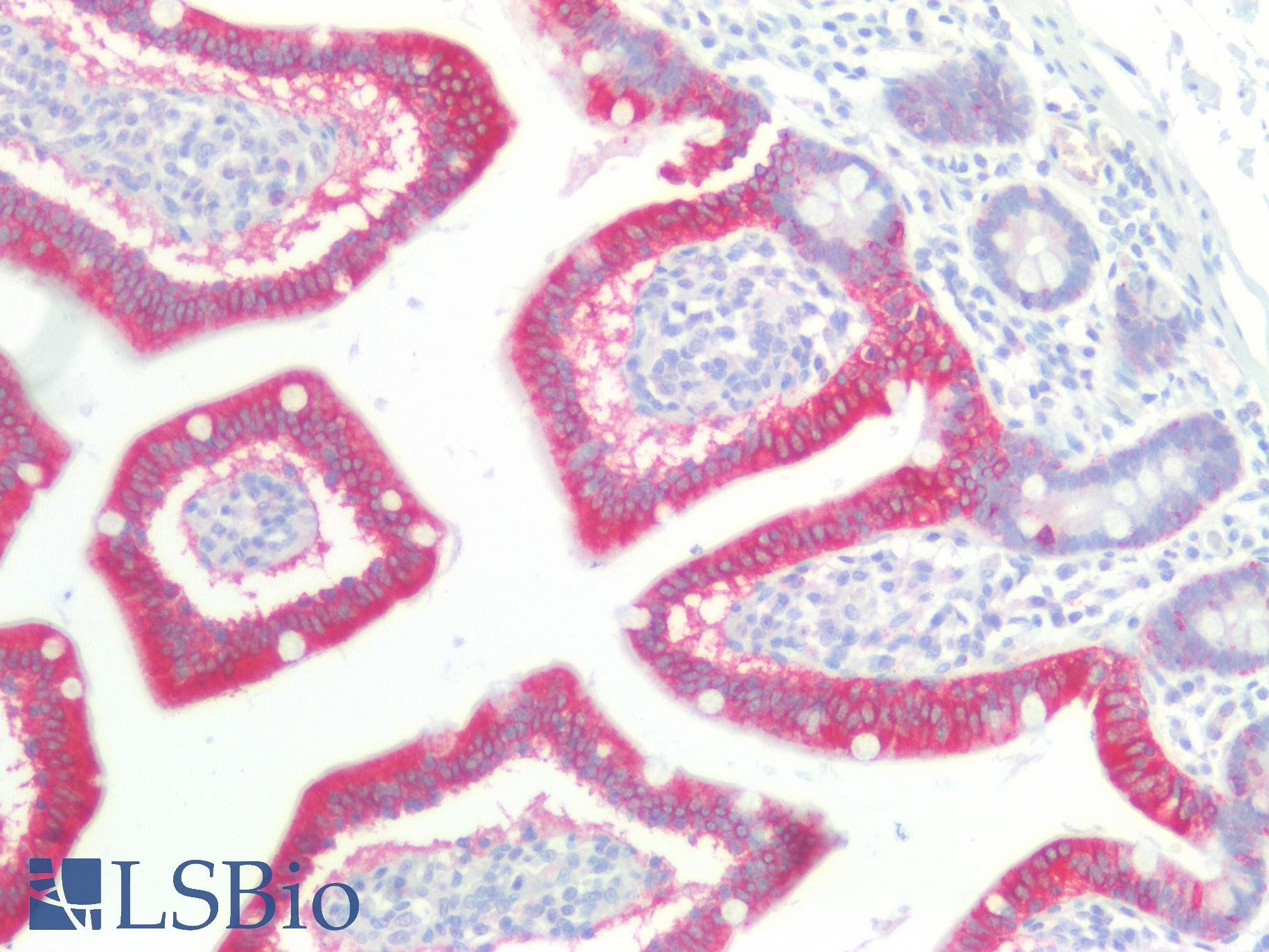 CTNNBIP1 / ICAT Antibody - Human Small Intestine: Formalin-Fixed, Paraffin-Embedded (FFPE)