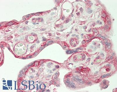 CTNND1 / p120 Catenin Antibody - Human Placenta: Formalin-Fixed, Paraffin-Embedded (FFPE)